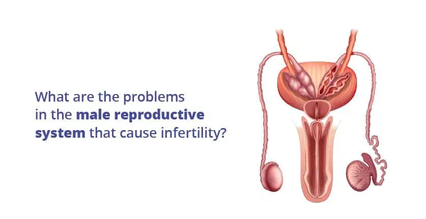पुरुष प्रजनन प्रणाली से संबंधित समस्याएं