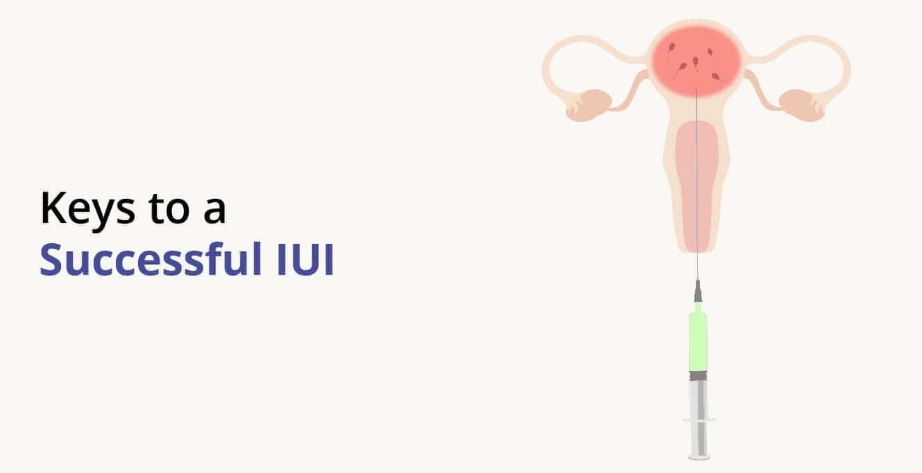 IUI Success Rate: Factors, Tips & Chances of Pregnancy