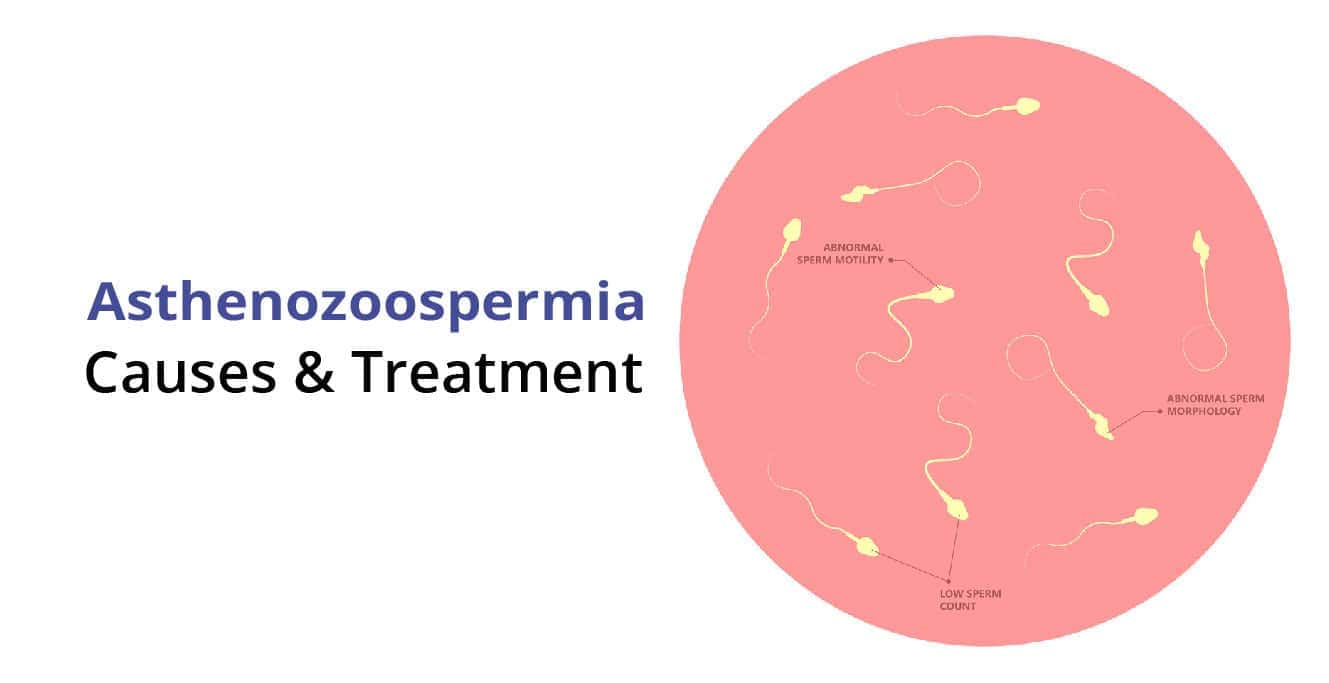 अस्थेनोजोस्पर्मिया क्या है