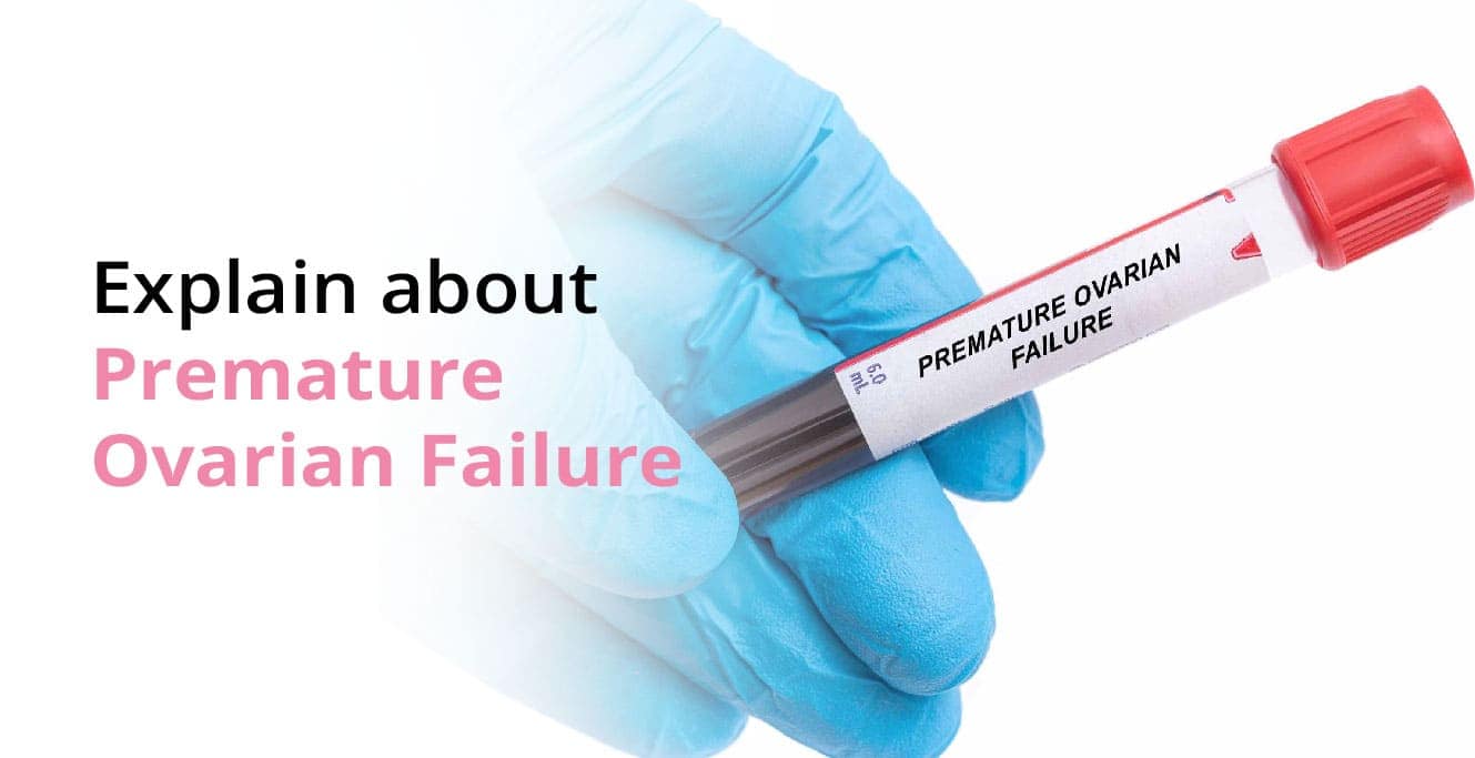 What is Premature Ovarian Failure?