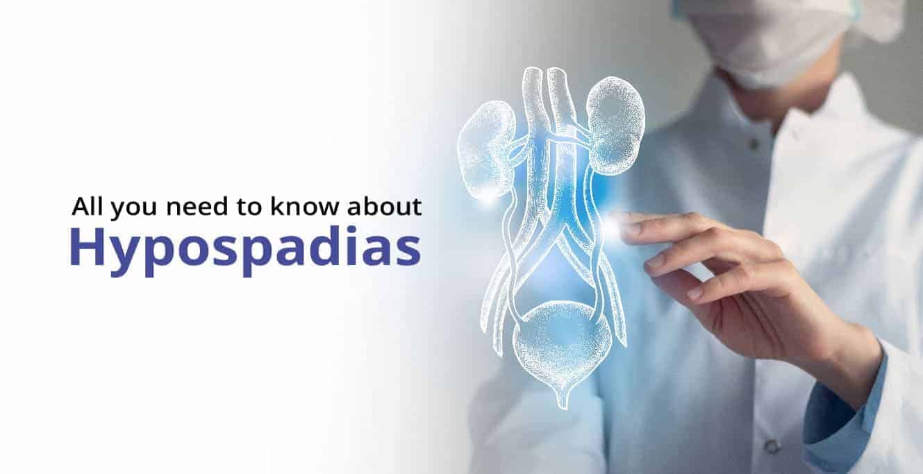 Hypospadias म्हणजे काय? – कारणे आणि लक्षणे