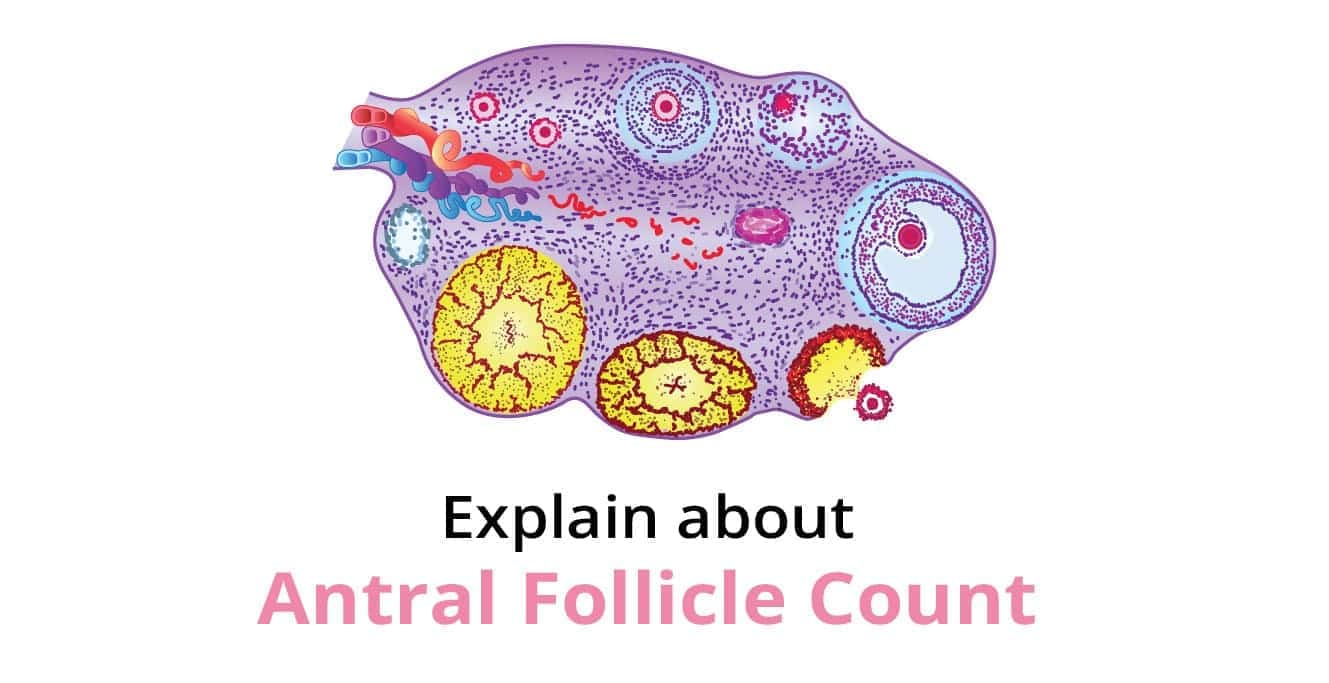 Antral Follicle Count (AFC): Key to Ovarian Reserve & Fertility