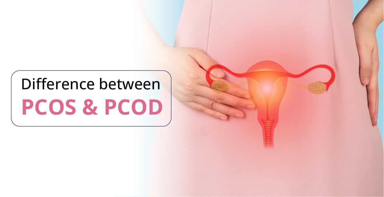 What is the Difference Between PCOS and PCOD