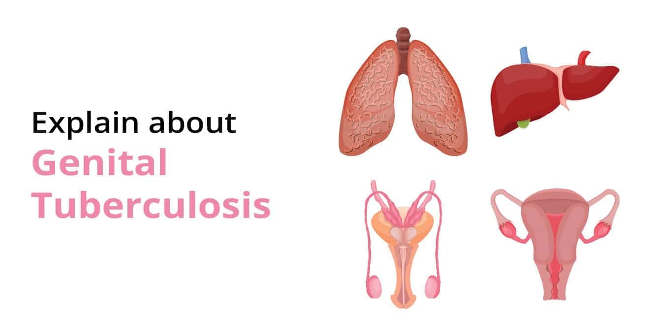 What is Genital Tuberculosis? | Causes & Symptoms