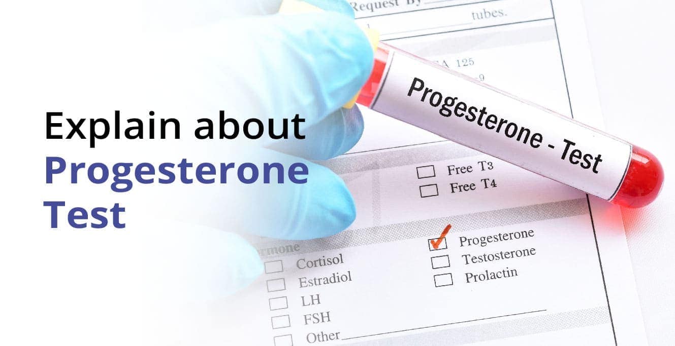 All About the Progesterone Test