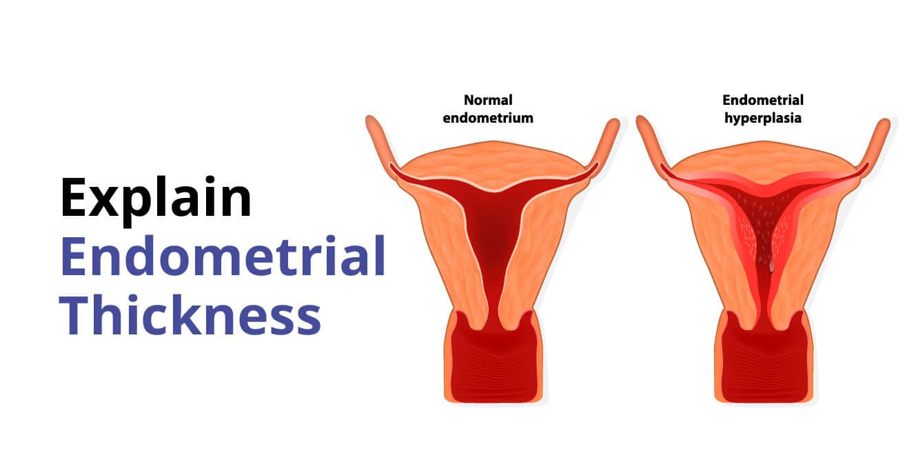 एंडोमेट्रियल मोटाई: आपको क्या जानना चाहिए
