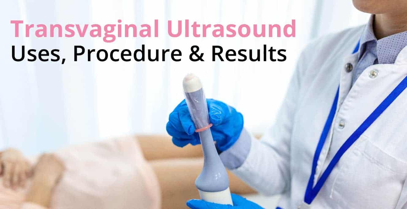 Everything You Need to Know About Transvaginal Ultrasound