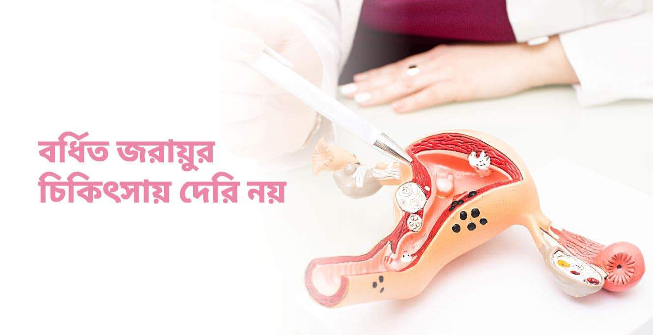 ভারী জরায়ু কি? (Bulky Uterus in Bengali)