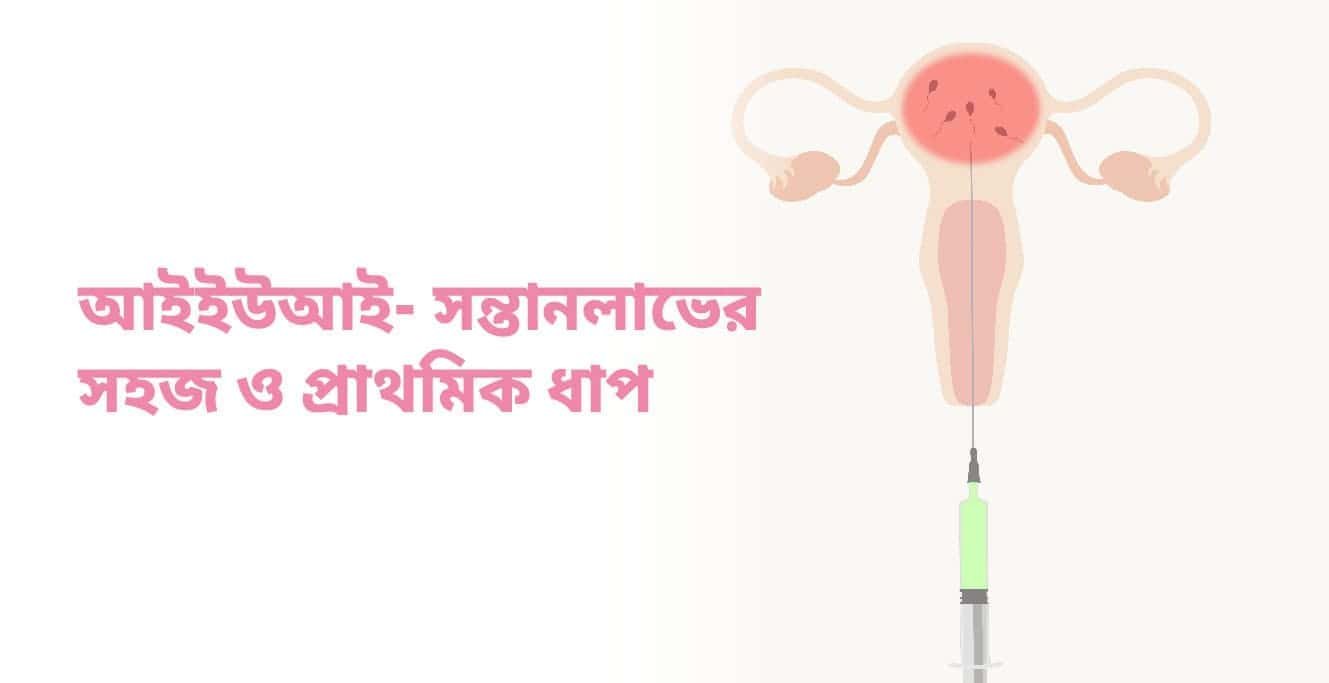 আইইউআই কি – প্রক্রিয়া, চিকিৎসা ও সুবিধা