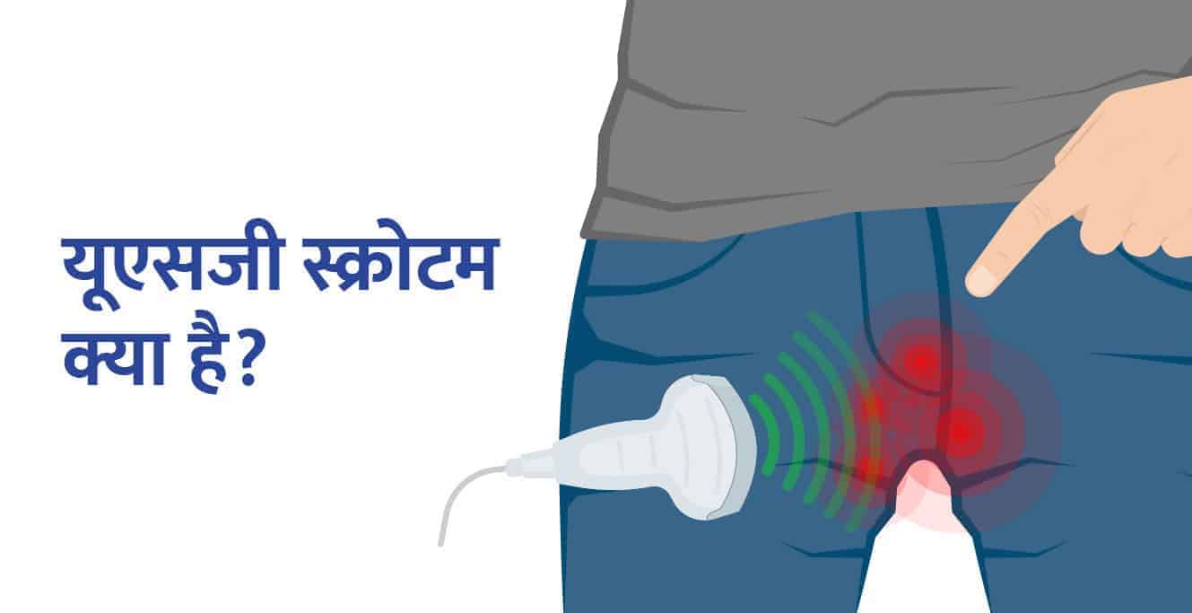 Scrotum Meaning in Hindi: यूएसजी स्क्रोटम क्या है?