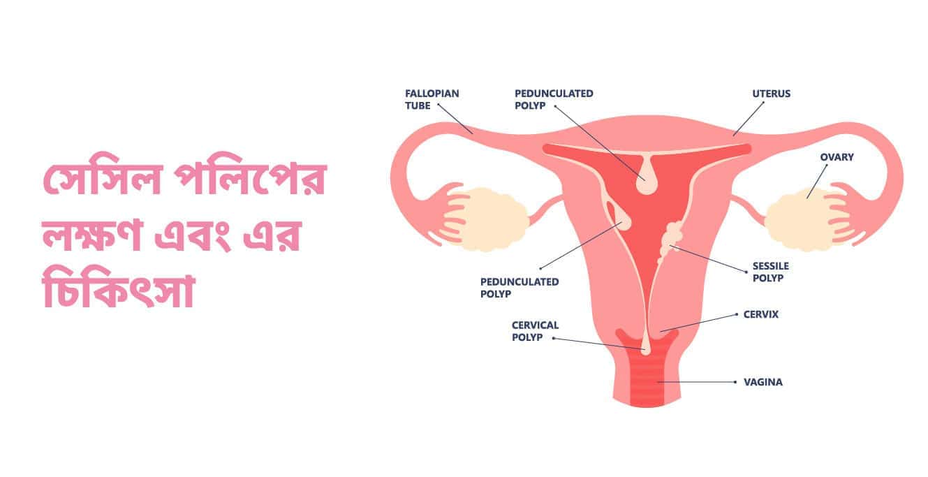 ক্যান্সারের ঝুঁকি এড়াতে সতর্ক থাকুন সিসিলইল পেলক