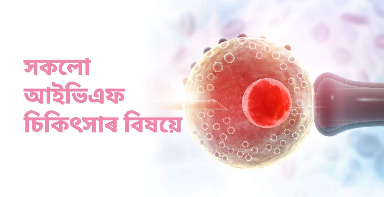 All about IVF(আইভিএফ কি)