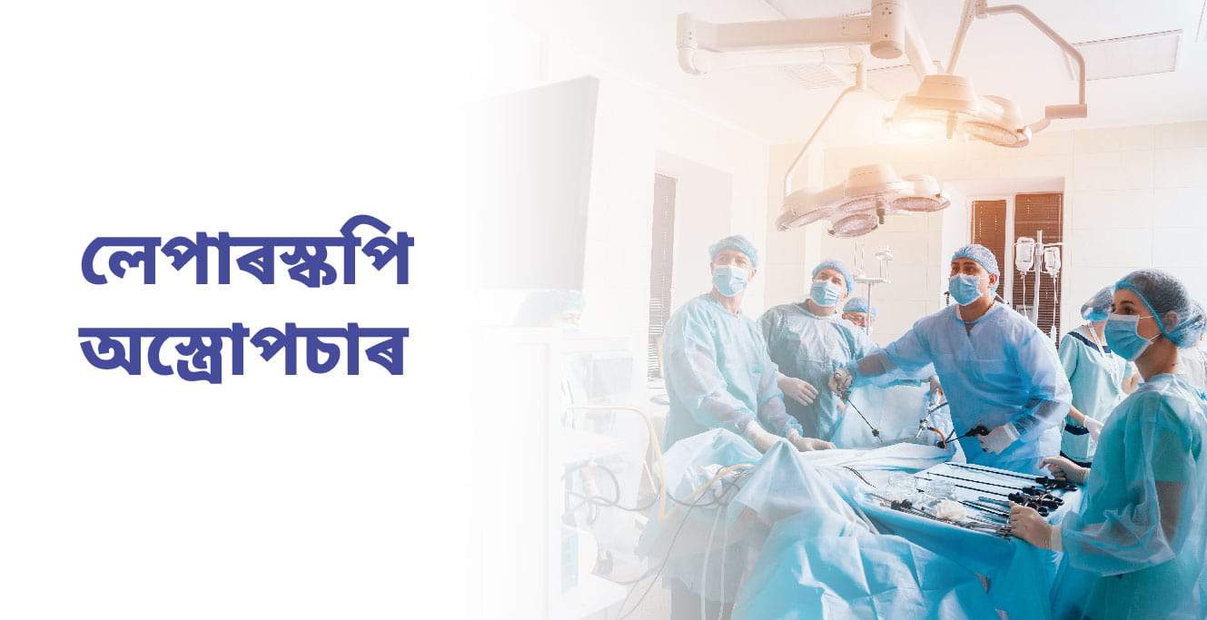 All about Laparoscopy Surgery(লেপাৰোস্কপি অস্ত্ৰোপচাৰ)