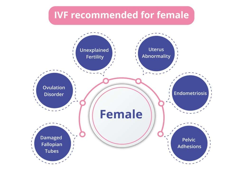 Diagram showing reasons IVF is recommended for females, including unexplained fertility, ovulation disorder, damaged fallopian tubes, uterus abnormality, endometriosis, and pelvic adhesions.