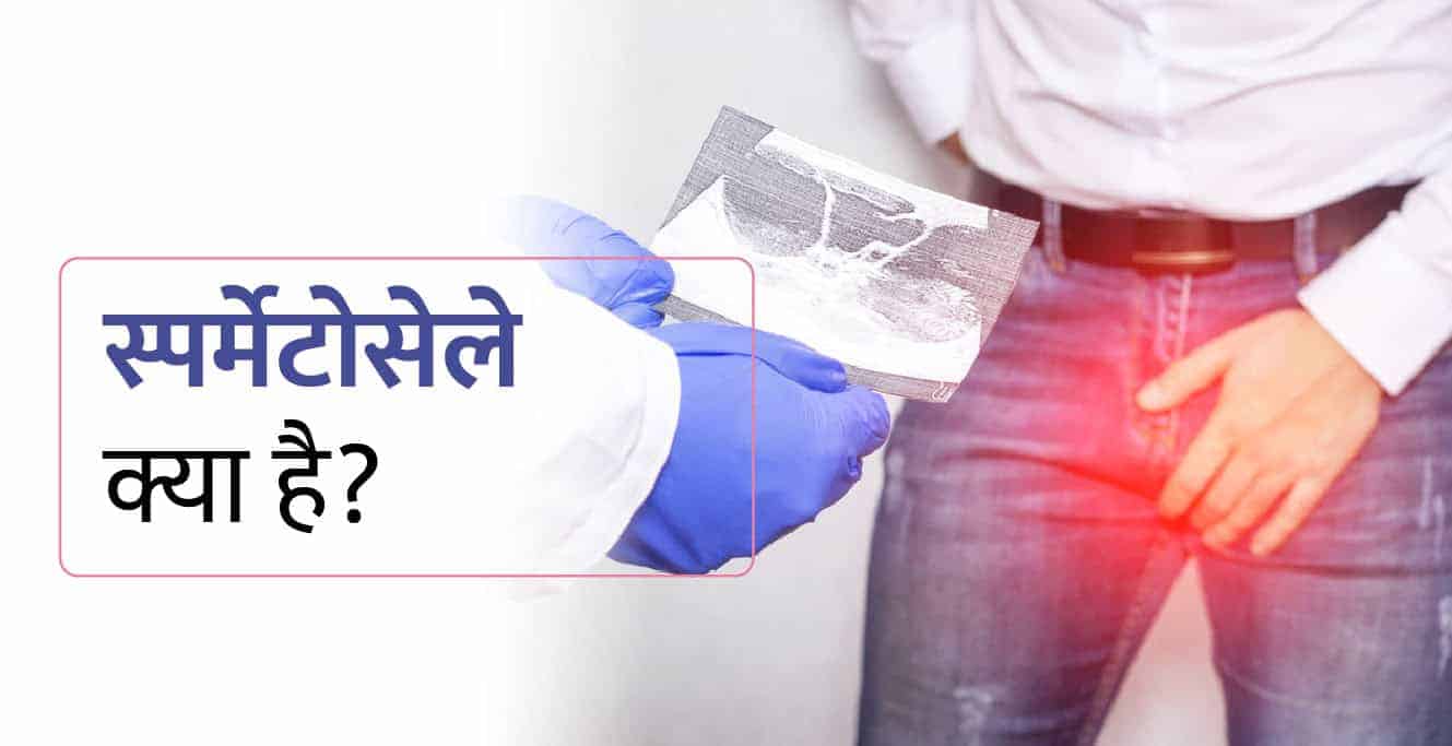 स्पर्माटोसील क्या है? कारण, लक्षण और इलाज – Spermatocele in Hindi