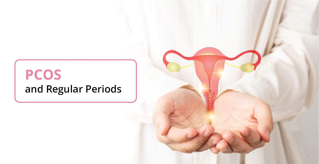 Living with PCOS and Regular Periods: What You Need to Know