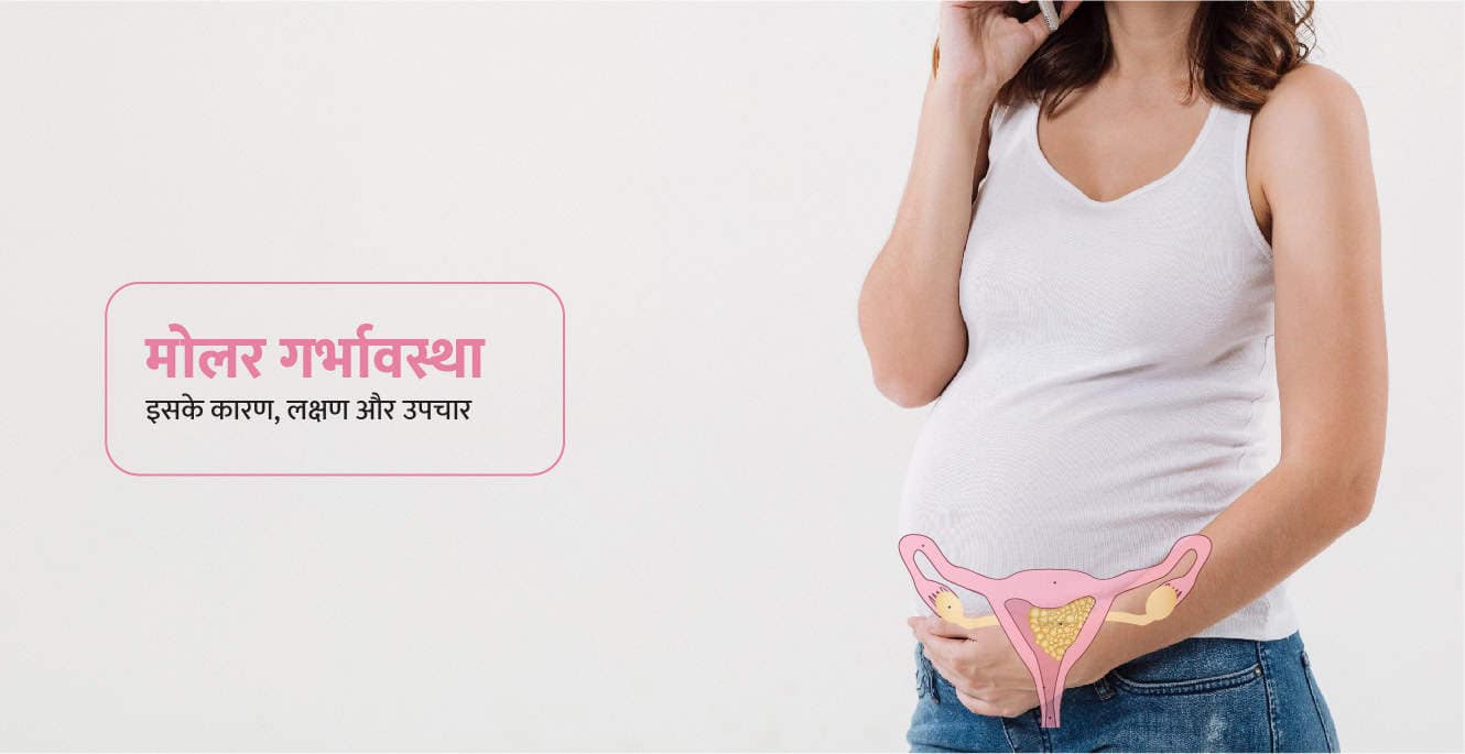 मोलर प्रेगनेंसी: इसके कारण, लक्षण और उपचार – Molar Pregnancy in Hindi