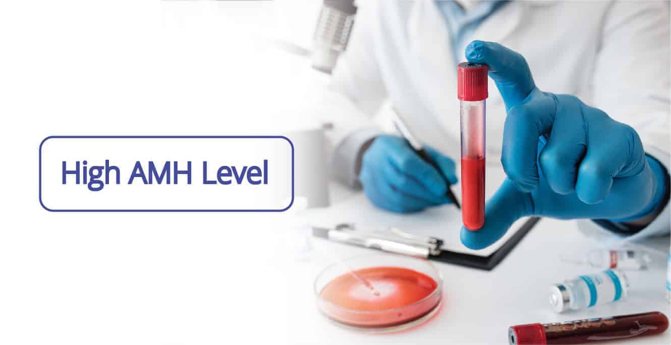 Understanding High AMH Levels and Their Impact on Fertility Treatments