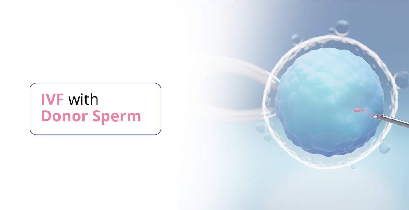 IVF with Donor Sperm: What to Expect and How it Works