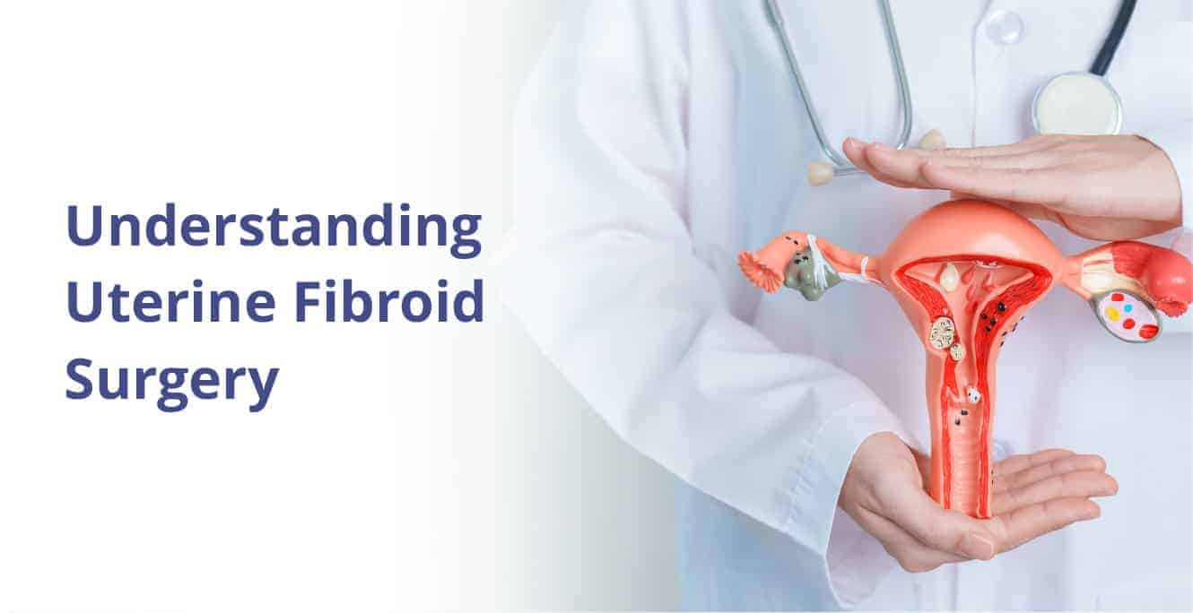 Empowering Fertility: The Role of Uterine Fibroid Surgery in Successful Pregnancy