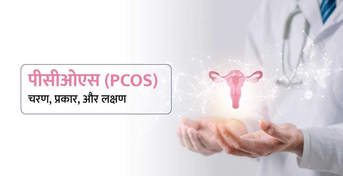 PCOS Meaning in Hindi: पीसीओएस के चरण, प्रकार, और लक्षण