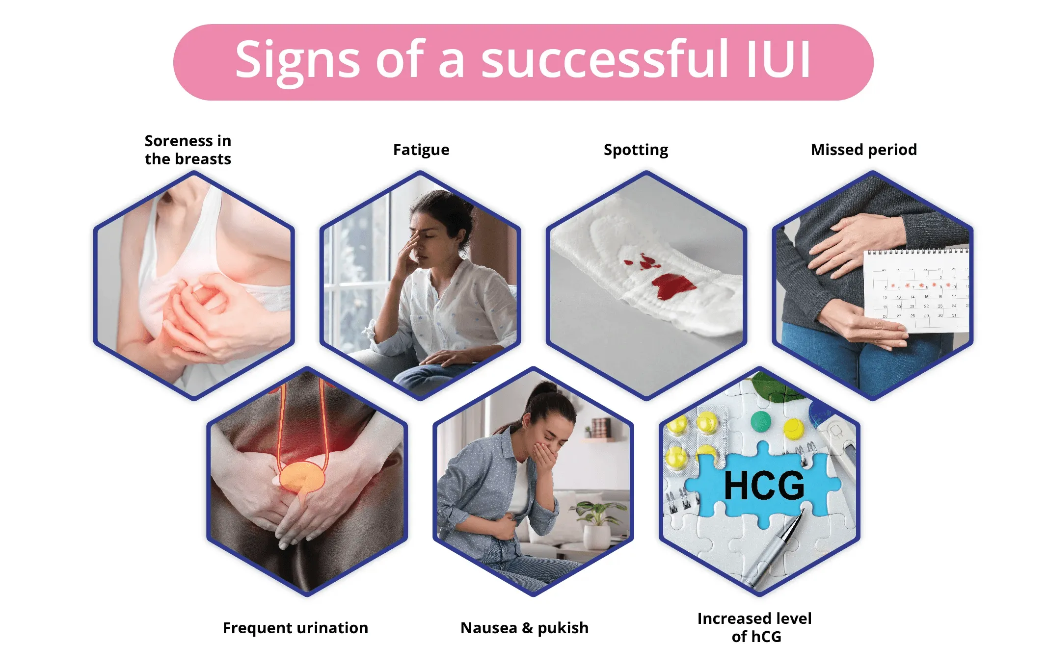 Signs of a successful IUI