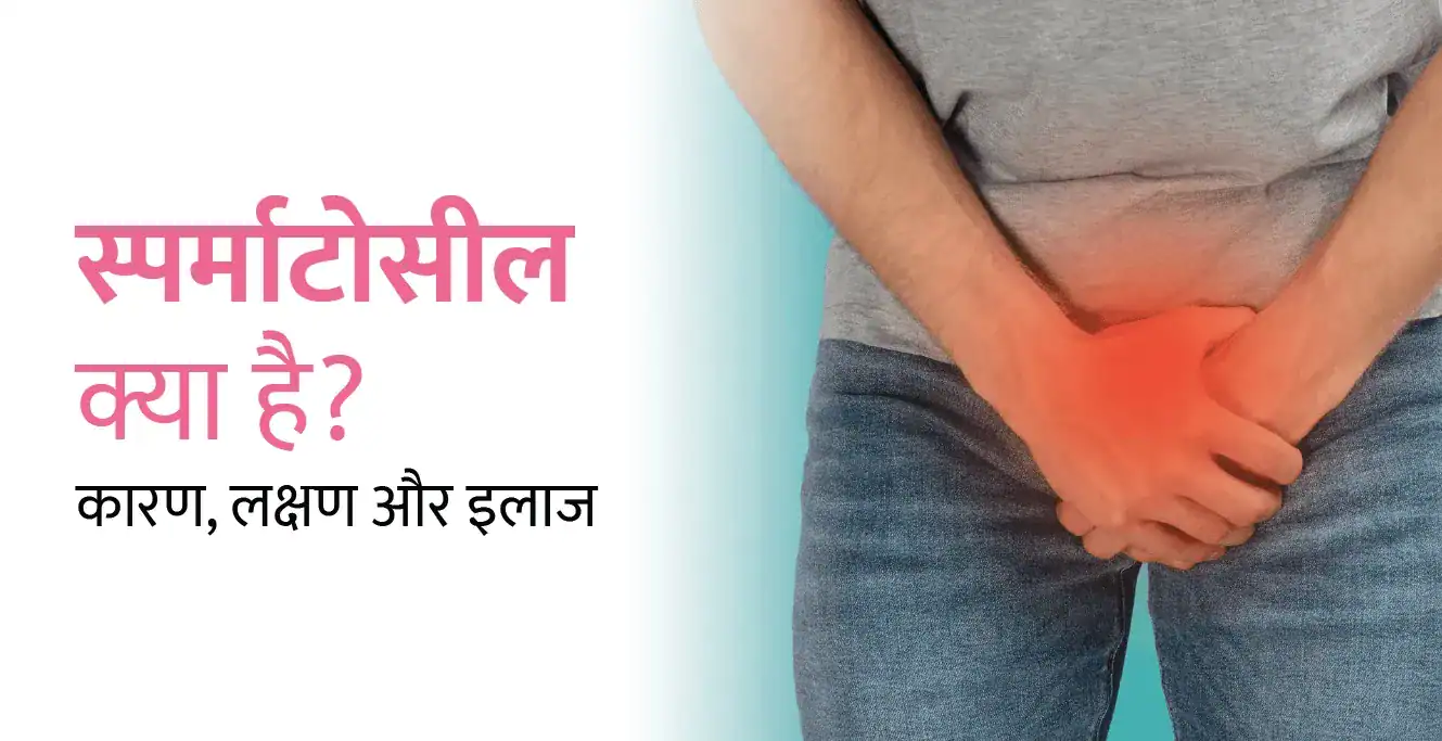 Spermatocele in Hindi – स्पर्माटोसील क्या है? कारण, लक्षण और इलाज
