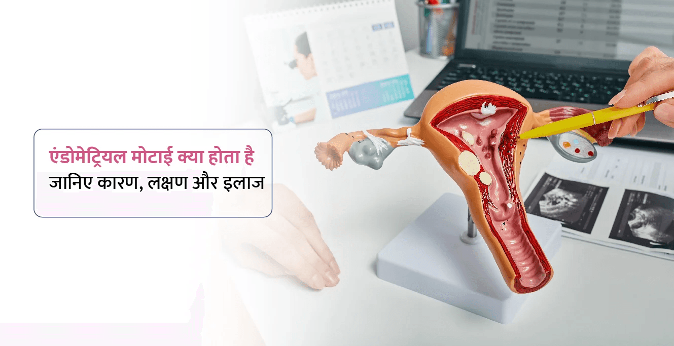 एंडोमेट्रियल मोटाई क्या होता है (Endometrial Thickness in Hindi): जानिए कारण, लक्षण और इलाज