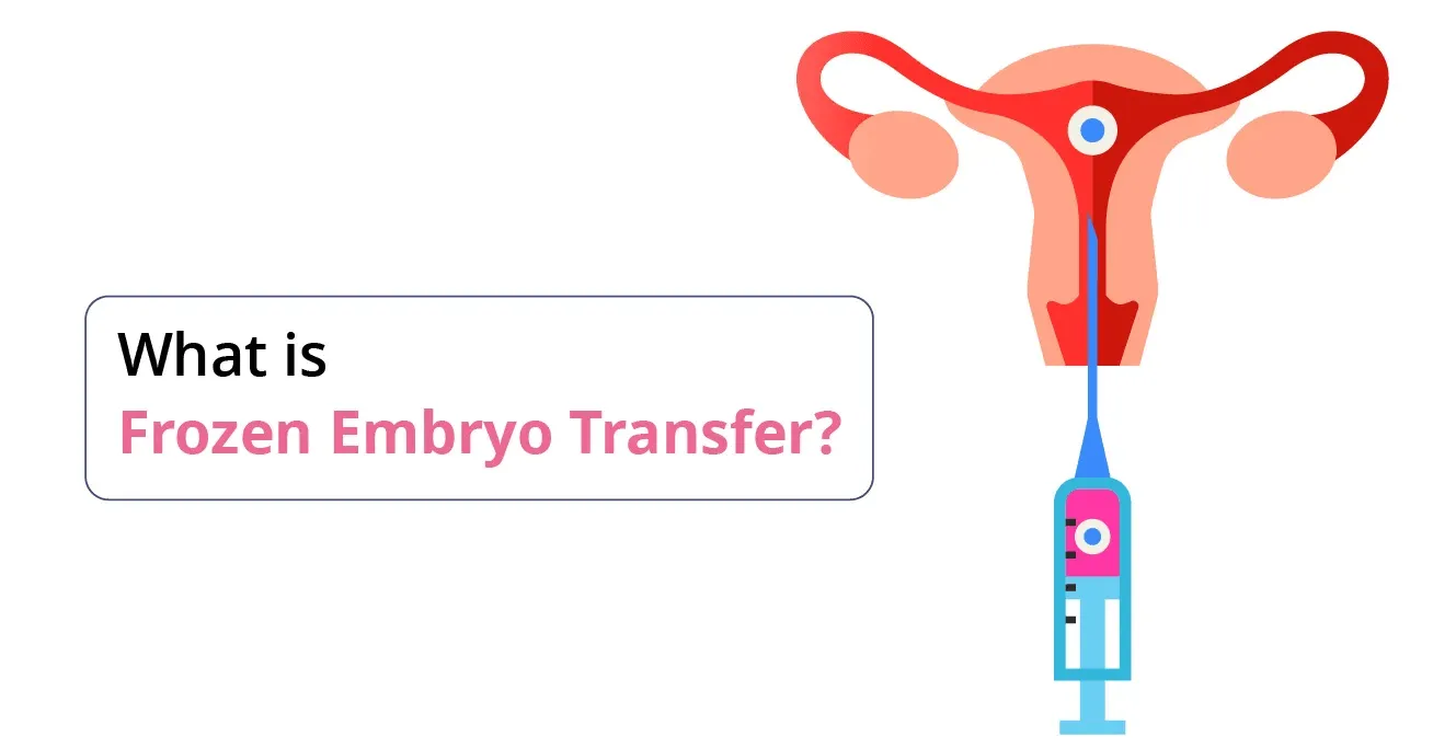 Frozen Embryo Transfer Process: Step-by-Step Guide