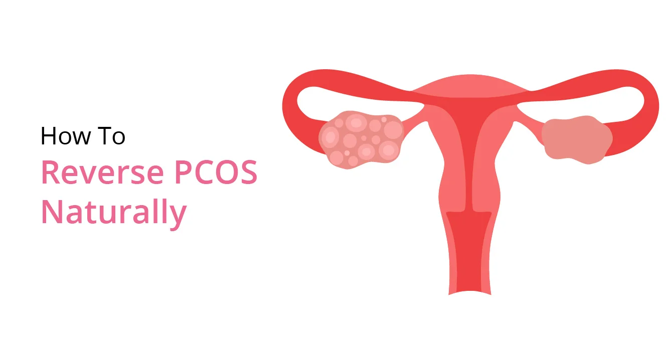 PCOS ஐ இயற்கையாக மாற்றுவது எப்படி