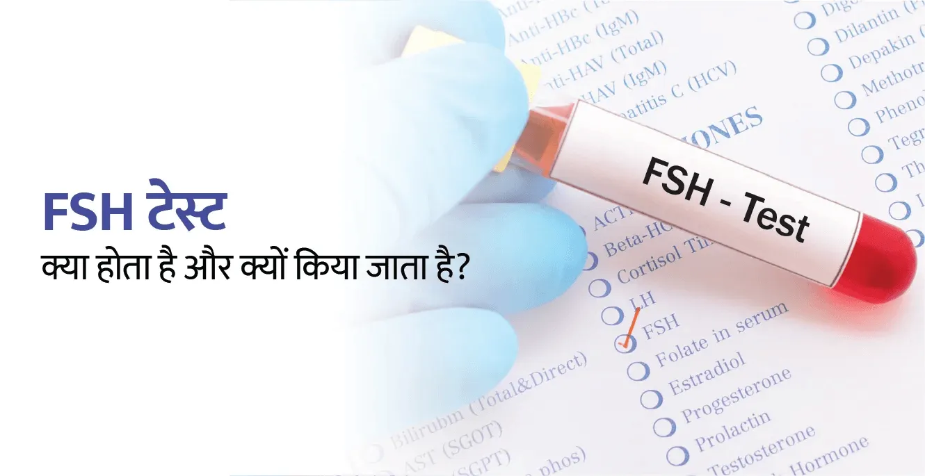 FSH Test in Hindi: एफएसएच टेस्ट क्या होता है और क्यों किया जाता है?