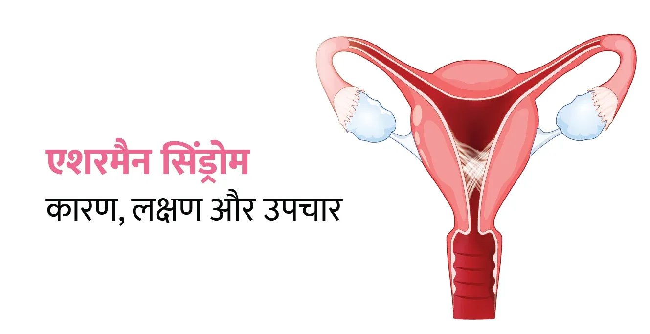 एशरमैन सिंड्रोम: कारण, लक्षण और उपचार
