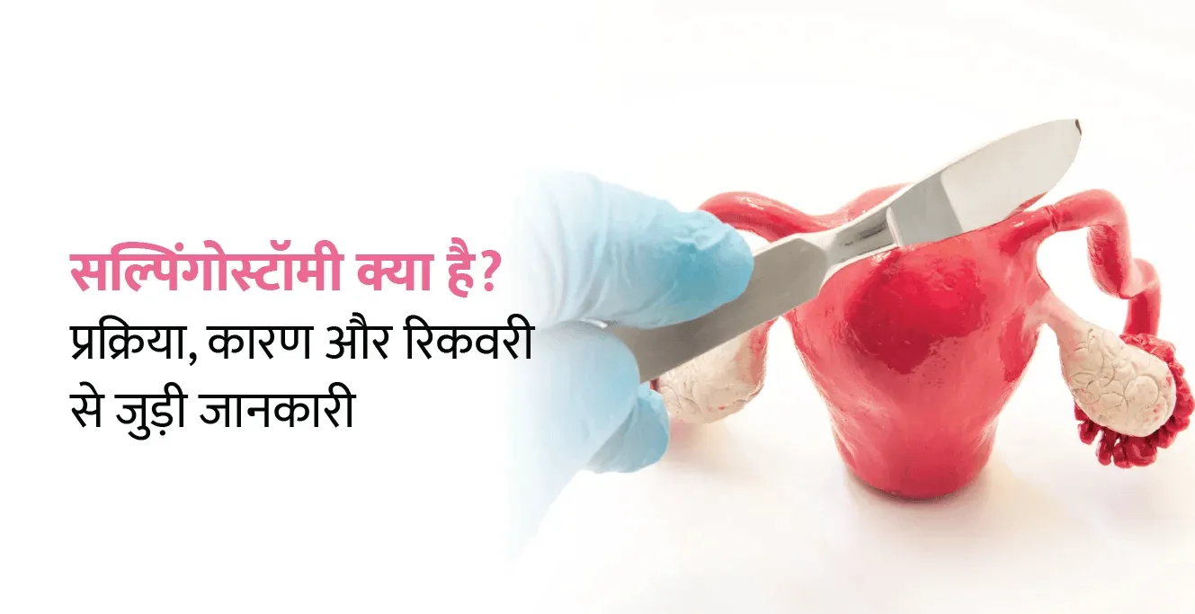 सल्पिंगोस्टॉमी क्या है? प्रक्रिया, कारण और रिकवरी से जुड़ी जानकारी