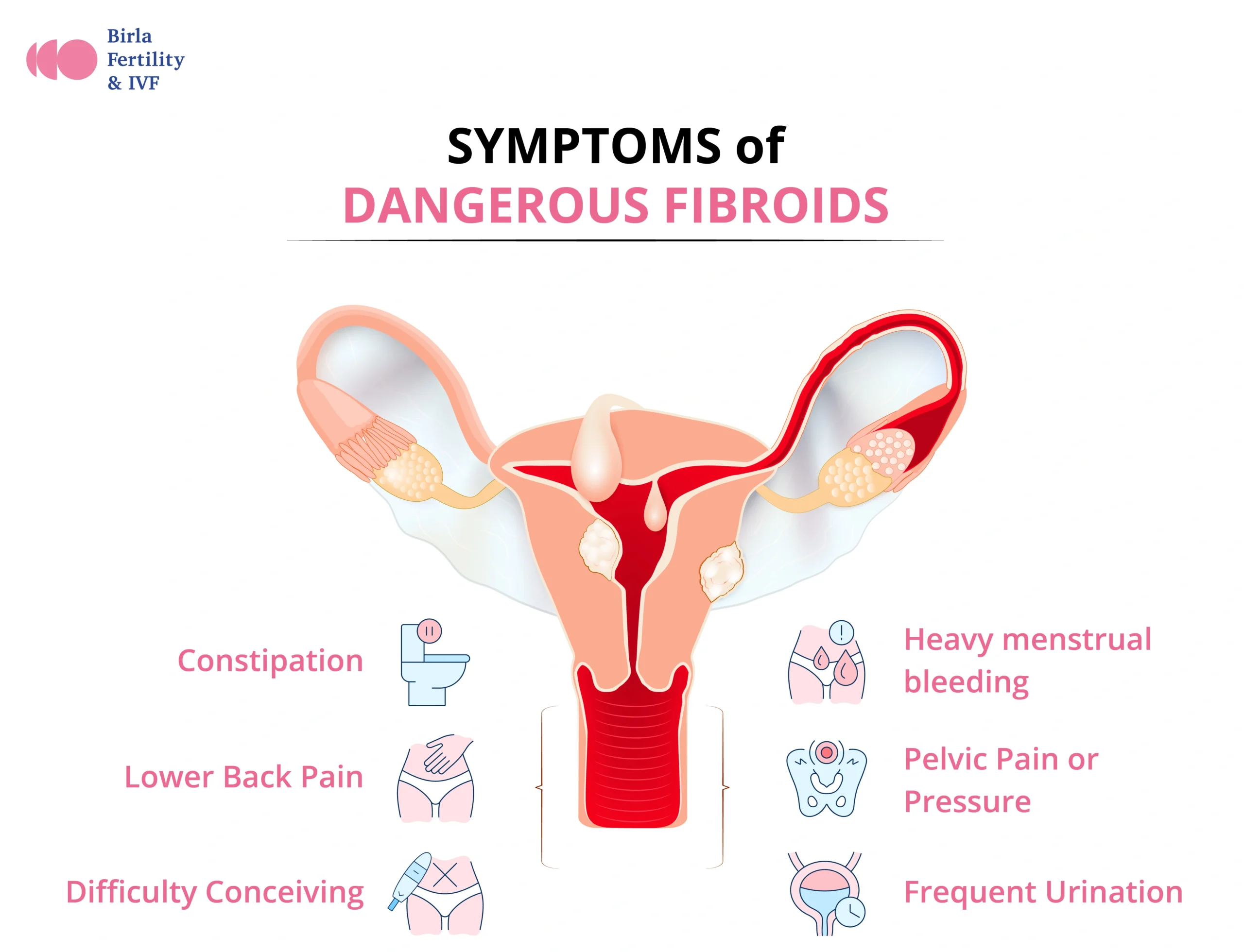 symptoms of dangerous fibroids