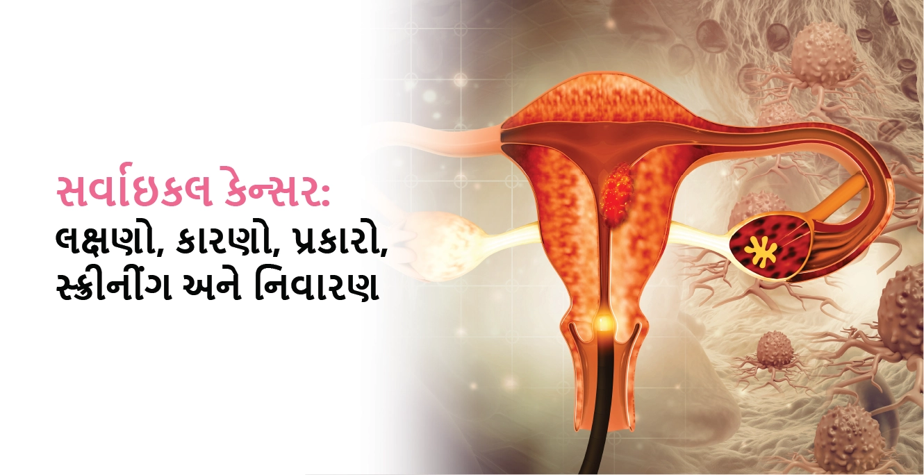 સર્વાઇકલ કેન્સર: લક્ષણો, કારણ, પ્રકાર, સ્ક્રીનિંગ અને નિવારણ