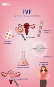 In vitro fertilization (IVF) Process